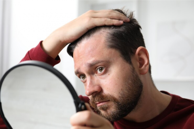 Tratamento Calvície Masculina: Descubra as Melhores Soluções e Resultados Tratamento Calvície Masculina: Descubra as Melhores Soluções e Resultados