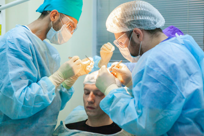 Clínica Que Faz Procedimento de Implante Capilar Cuiabá Chapadão do Sul - Procedimento Implante Capilar