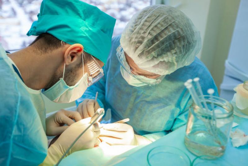 Onde Fazer Procedimento de Implante Capilar para Redução de Coroa Canarana - Procedimento para Implante de Cabelos