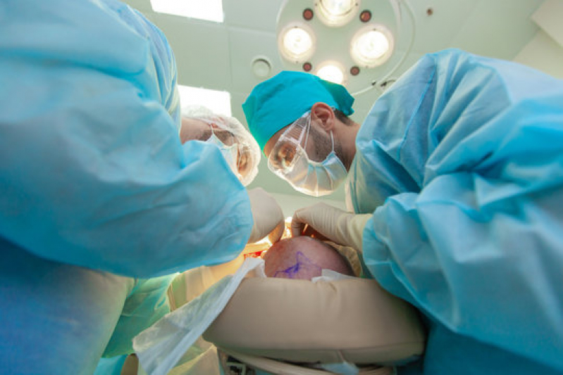 Procedimento de Implante Capilar na Coroa Tangará da Serra - Implante Capilar para Coroa Grande