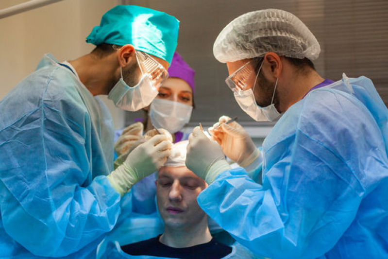 Procedimento para Implante de Cabelo Agendar Alto Garças - Procedimento para Implante de Cabelos