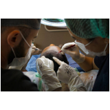 clínica para cirurgia de implante capilar nas entradas Sinop