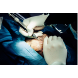 clínica que faz cirurgia calvície masculina Octogonal