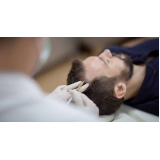 tratamento de mesoterapia capilar masculina Luziânia